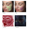 VISIA® Skin Analysis