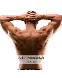 Laser Hair Removal - Extra Large Area