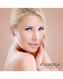 Smoothbeam Laser for Acne