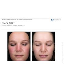 ClearSilk®