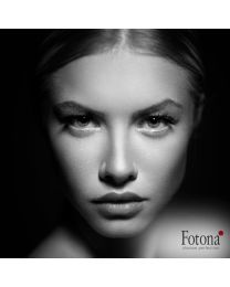 Laser Acne Treatment Consultation