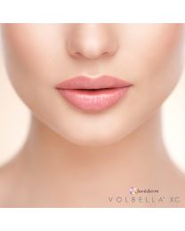 JUVÉDERM VOLBELLA® XC