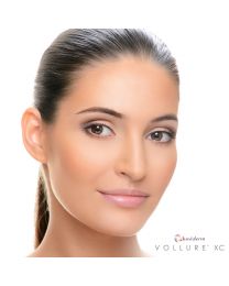 JUVÉDERM VOLLURE™ XC