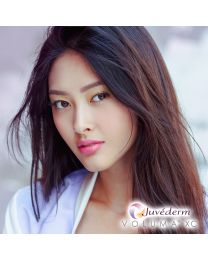 JUVÉDERM VOLUMA®  XC - NOBD