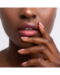 Restylane® KYSSE
