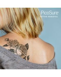 Laser Tattoo Removal Consultation