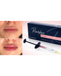 Restylane® KYSSE