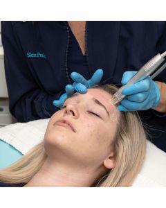 HydraDermabrasion Treatment