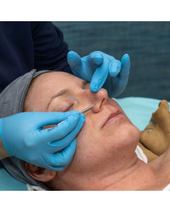 Acne Resolution Treatment