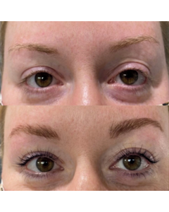 Brow Lamination with Eyelash Lift and Tint