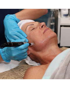 Collagen Induction Therapy