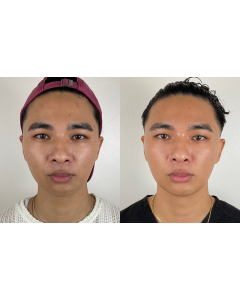 skinvive_skinvive_66134