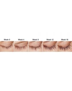 Latisse® 5mL