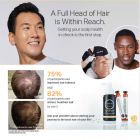Keravive scalp treatment men