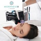 Morpheus8 Pkg of 3 Full Face