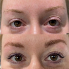 Brow Lamination with Eyelash Lift and Tint