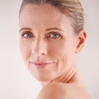 SkinPen® + Ultra Laser Package Special