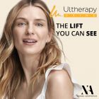 Ultherapy Prime