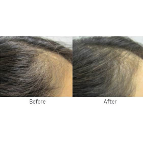 Viviscal Hair Growth PRO Tablets  Omniya Clinic London