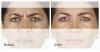 XEOMIN B&A 3