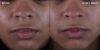 B & A