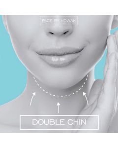 CoolSculpting® Double Chin Treatment