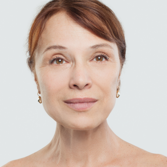 Ultherapy