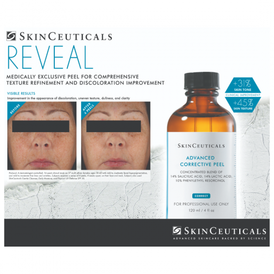 SkinCeuticals Advanced Corrective Peel