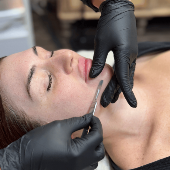 Dermaplane