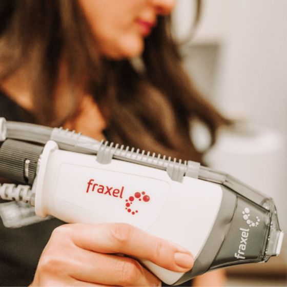 Fraxel Restore Laser Resurfacing