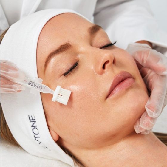 Glycolic Peel