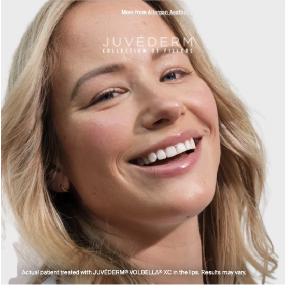 JUVÉDERM VOLBELLA® XC 