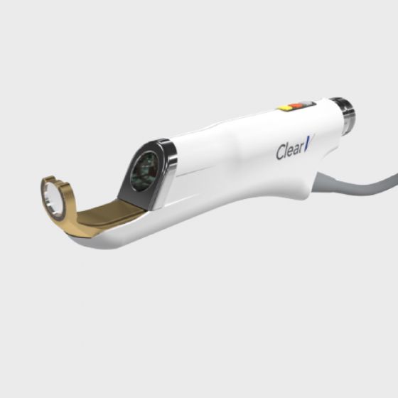 Leg Vein Clearscan Laser Treatment