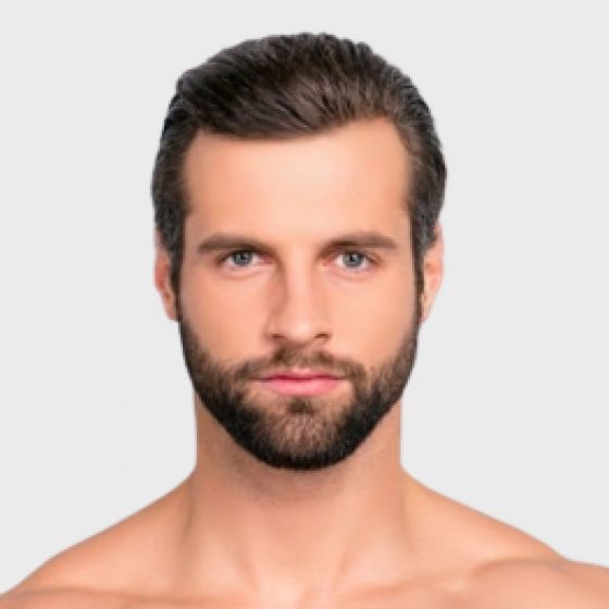 MicroLaser Skin Peel