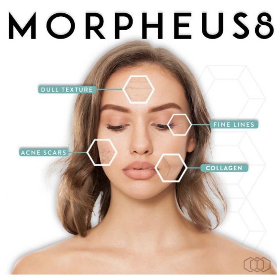 InMode Morpheus8