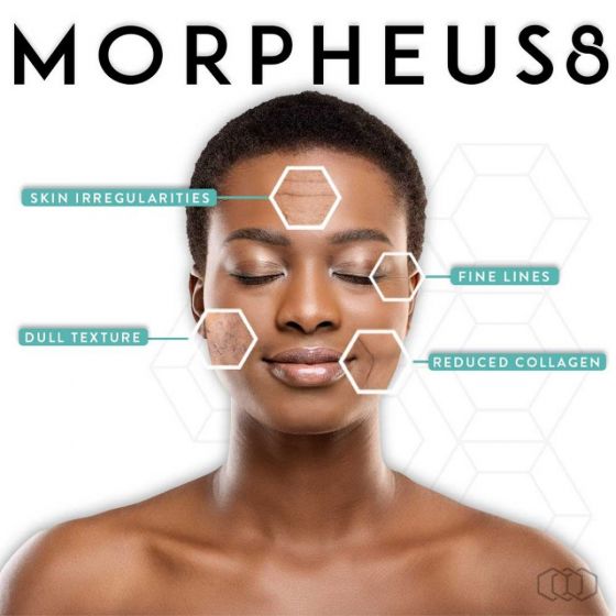 InMode Morpheus8