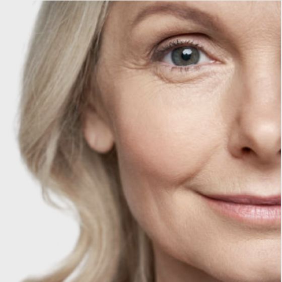 PRP Protocol + Microneedling + Layered/Injected PRP