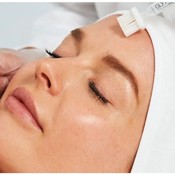 Glytone Pyruvic Acid Peel