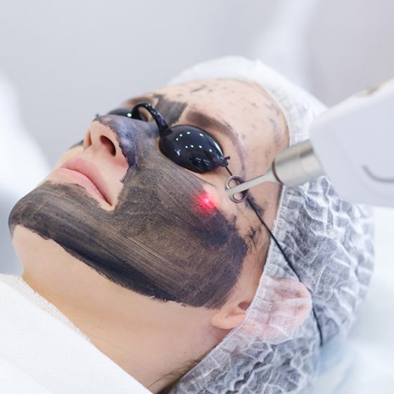 Spectra laser Treatment