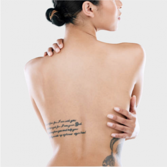 Spectra for Laser Tattoo Removal
