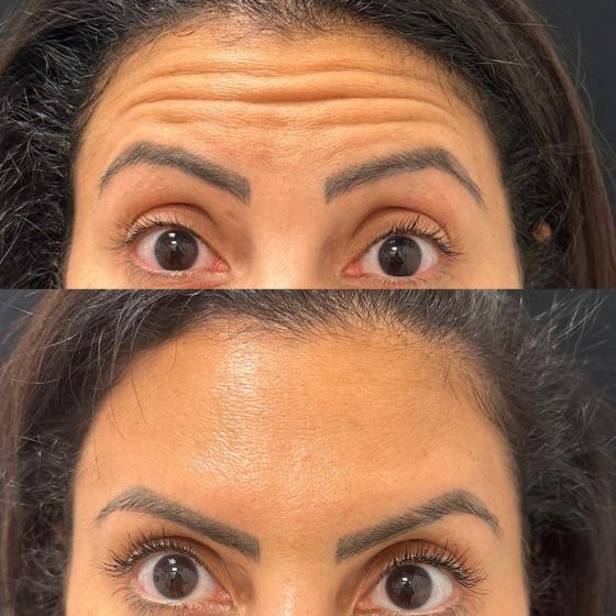 A Year of Smooth