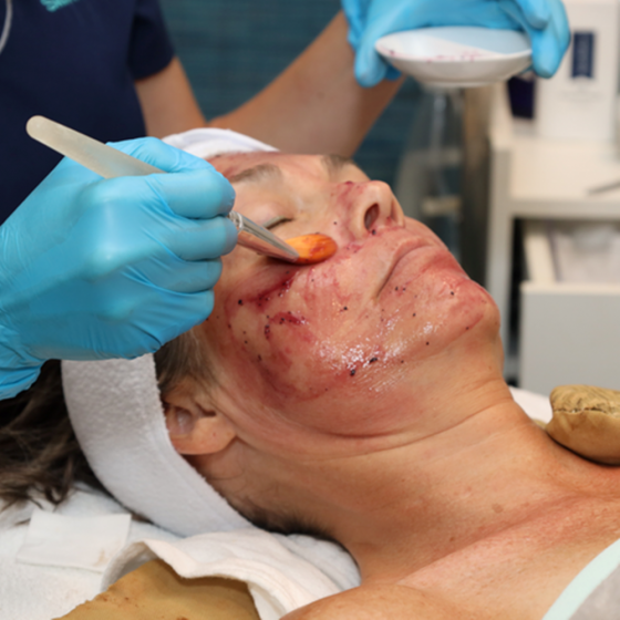 Age Defy Platinum Treatment