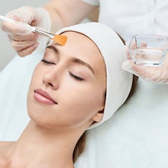 Chemical Peels