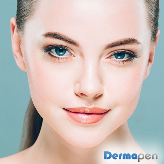 Microneedling with PRP