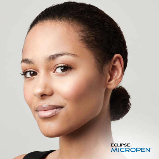 Eclipse Microneedling with PRP (2 Options)