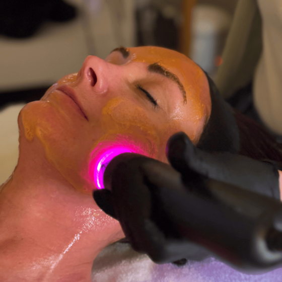glo2facial1