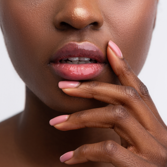 JUVÉDERM VOLBELLA® XC