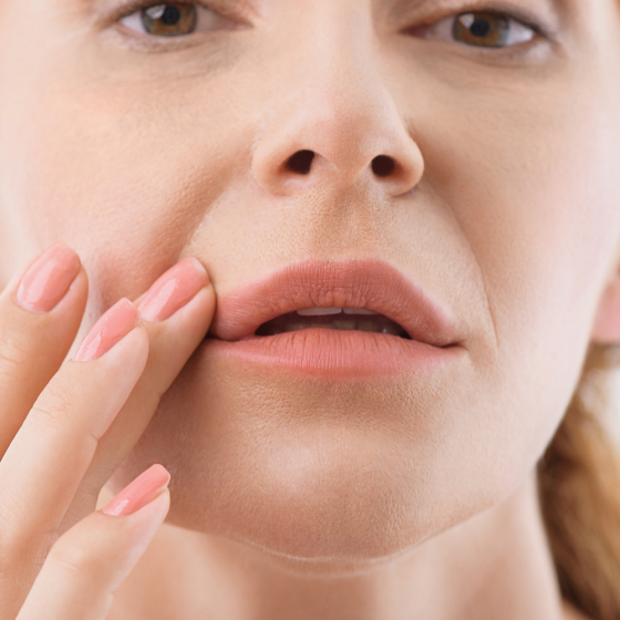 JUVÉDERM® Ultra Plus XC