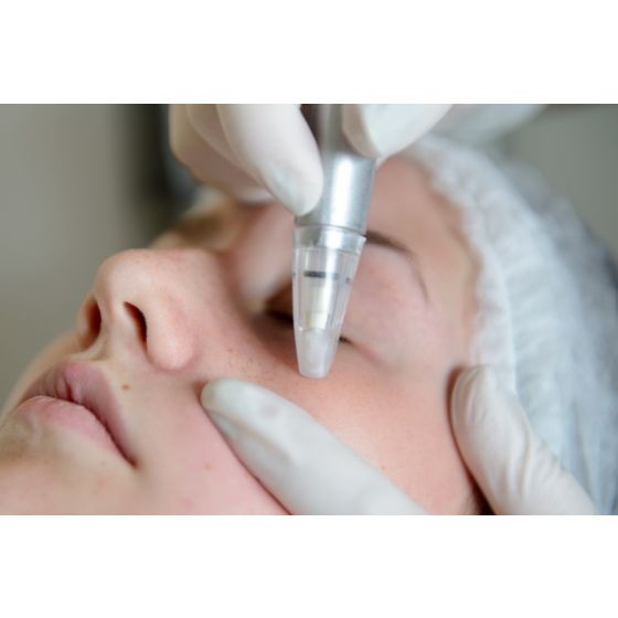 microderm facial