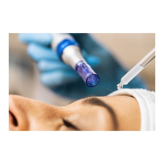 microneedling 